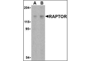 Western blot analysis of Raptor in L1210 cell lysate with this product at (A) 2 and (B) 4 μg/ml. (RAPTOR 抗体  (C-Term))