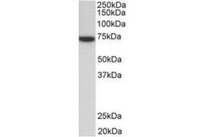 Western Blotting (WB) image for anti-zeta-Chain (TCR) Associated Protein Kinase 70kDa (ZAP70) (Internal Region) antibody (ABIN1109533) (ZAP70 抗体  (Internal Region))