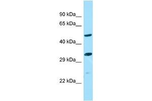 WB Suggested Anti-ALG10B Antibody Titration: 1. (ALG10B 抗体  (Middle Region))