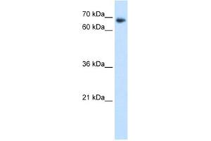 WB Suggested Anti-TAF6 Antibody Titration:  1. (TAF6 抗体  (N-Term))