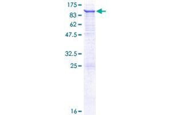 VPS45 Protein (AA 1-570) (GST tag)