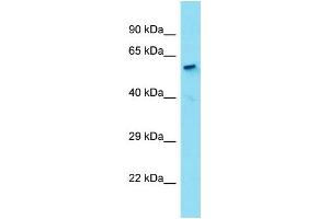 Host:  Rabbit  Target Name:  HDAC1  Sample Type:  Liver Tumor lysates  Antibody Dilution:  1. (HDAC1 抗体  (N-Term))