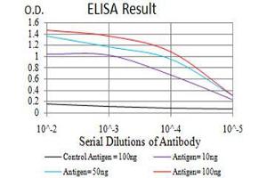 Black line: Control Antigen (100 ng),Purple line: Antigen (10 ng), Blue line: Antigen (50 ng), Red line:Antigen (100 ng) (GFPT1 抗体  (AA 536-681))