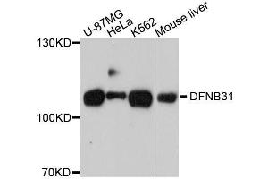 Western blot analysis of extracts of various cell lines, using WHRN antibody. (DFNB31 抗体  (AA 708-907))