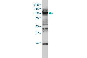 Western Blotting (WB) image for anti-General Transcription Factor IIIC, Polypeptide 2, beta 110kDa (GTF3C2) (AA 1-912) antibody (ABIN598719) (GTF3C2 抗体  (AA 1-912))