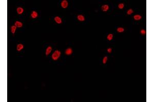 ABIN6269018 staining COS7 by IF/ICC. (HDAC10 抗体)