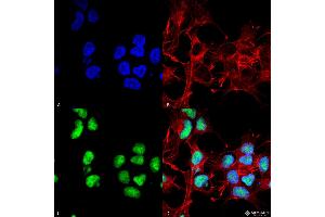 Immunocytochemistry/Immunofluorescence analysis using Rabbit Anti-Choline Acetyltransferase Polyclonal Antibody . (Choline Acetyltransferase 抗体  (N-Term) (HRP))
