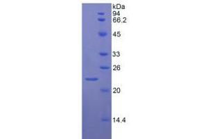 SDS-PAGE analysis of Rat vWF Protein. (VWF 蛋白)