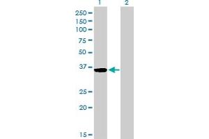 Western Blot analysis of GSC expression in transfected 293T cell line by GSC monoclonal antibody (M03), clone 3D11. (GSC 抗体  (AA 151-257))