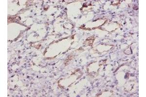 Immunohistochemistry (IHC) image for anti-Superoxide Dismutase 1, Soluble (SOD1) (AA 2-154) antibody (ABIN7177879)