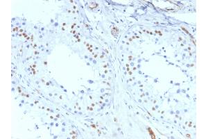 ABIN6383829 to WT1 was successfully used to stain nuclei in sections of human mesothelioma and in human and rat testis sections. (Recombinant WT1 抗体)