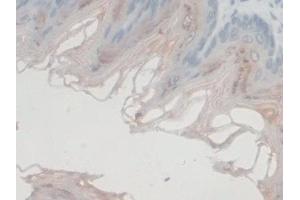 Immunohistochemistry (IHC) image for anti-G-Elongation Factor, Mitochondrial 1 (GFM1) (AA 511-751) antibody (ABIN7444172)