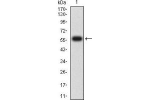 Western blot analysis using CD1C mAb against human CD1C (AA: extra 18-302) recombinant protein. (CD1c 抗体  (AA 18-302))