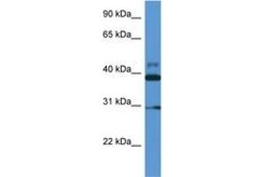 Image no. 1 for anti-Vasodilator-Stimulated phosphoprotein (VASP) (AA 127-176) antibody (ABIN6746957) (VASP 抗体  (AA 127-176))