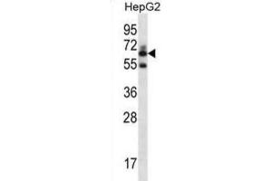 Western Blotting (WB) image for anti-gamma-Glutamyltransferase 2 (gGT2) antibody (ABIN2996985) (gGT2 抗体)