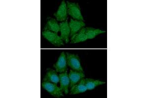 ICC/IF analysis of BLyS in HeLa cells line, stained with DAPI (Blue) for nucleus staining and monoclonal anti-human BLyS antibody (1:100) with goat anti-mouse IgG-Alexa fluor 488 conjugate (Green) (BAFF 抗体)