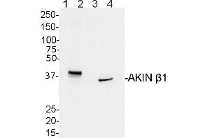 Image no. 1 for anti-SNF1-Related Protein Kinase Regulatory Subunit beta-1 (AKINBETA1) (Regulatory Subunit beta) antibody (ABIN488525) (AKINB1 抗体  (Regulatory Subunit beta))