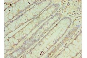 Immunohistochemistry of paraffin-embedded human colon tissue using ABIN7149543 at dilution of 1:100 (CRADD 抗体  (AA 1-199))