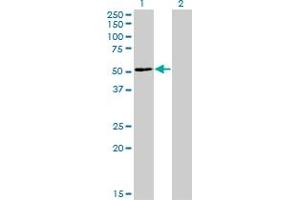 Western Blot analysis of ZNF323 expression in transfected 293T cell line by ZNF323 monoclonal antibody (M03), clone 4F7. (Zinc Finger and SCAN Domain Containing 31 (ZSCAN31) (AA 1-209) 抗体)