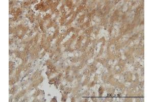 Immunoperoxidase of monoclonal antibody to AKR1C4 on formalin-fixed paraffin-embedded human liver tissue. (AKR1C4 抗体  (AA 1-323))