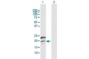 Western Blot analysis of CGB expression in transfected 293T cell line by CGB MaxPab polyclonal antibody. (CGB 抗体  (AA 1-165))