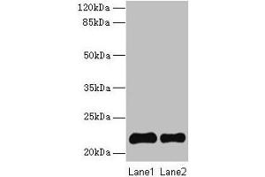 Western blot All lanes: SIRPD antibody at 14 μg/mL Lane 1: 293T whole cell lysate Lane 2: Mouse spleen tissue Secondary Goat polyclonal to rabbit IgG at 1/10000 dilution Predicted band size: 22 kDa Observed band size: 22 kDa (SIRPD 抗体  (AA 30-197))