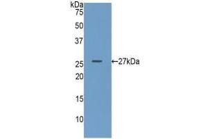 Detection of Recombinant GUSb, Human using Polyclonal Antibody to Glucuronidase Beta (GUSb) (Glucuronidase beta 抗体  (AA 451-649))