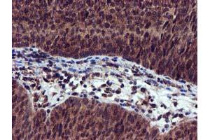 Image no. 7 for anti-EPM2A (Laforin) Interacting Protein 1 (EPM2AIP1) antibody (ABIN1498045) (EPM2AIP1 抗体)