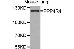 Western blot analysis of extracts of mouse lung cells, using PPP4R4 antibody. (PPP4R4 抗体)