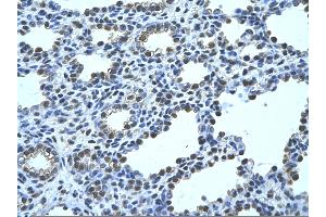 Rabbit Anti-FBP1 Antibody       Paraffin Embedded Tissue:  Human alveolar cell   Cellular Data:  Epithelial cells of renal tubule  Antibody Concentration:   4. (FBP1 抗体  (N-Term))