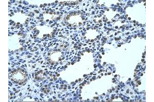Rabbit Anti-FBP1 Antibody       Paraffin Embedded Tissue:  Human alveolar cell   Cellular Data:  Epithelial cells of renal tubule  Antibody Concentration:   4.