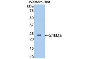 Western Blotting (WB) image for anti-Orosomucoid 1 (ORM1) (AA 19-207) antibody (ABIN1077769) (ORM1 抗体  (AA 19-207))