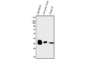 Western blot analysis of AKR1D1 using anti-AKR1D1 antibody (ABIN7602975).
