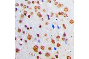 Immunohistochemical analysis of ADAR2 staining in human brain formalin fixed paraffin embedded tissue section. (RED1 抗体  (Center))