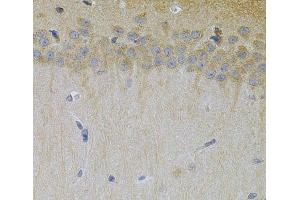 Immunohistochemistry of paraffin-embedded Mouse brain using ERBB3 Polyclonal Antibody at dilution of 1:100 (40x lens). (ERBB3 抗体)