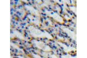 Used in DAB staining on fromalin fixed paraffin-embedded Spleen tissue (SIGLEC5 抗体  (AA 147-335))