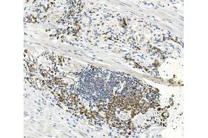 IHC analysis of EEF2 using anti-EEF2 antibody (ABIN7603141).