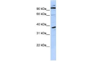 Western Blotting (WB) image for anti-PHD Finger Protein 11 (PHF11) antibody (ABIN2458372) (PHF11 抗体)