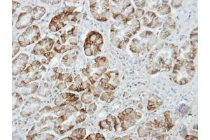 IHC-P Image Immunohistochemical analysis of paraffin-embedded human stomach, using UNC13D, antibody at 1:100 dilution. (UNC13D 抗体  (C-Term))