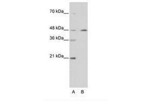 Image no. 2 for anti-Nuclear Receptor Subfamily 2, Group F, Member 2 (NR2F2) (AA 141-190) antibody (ABIN6736209) (NR2F2 抗体  (AA 141-190))