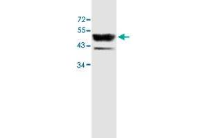 Western blot analysis of human fetal skeletal muscle lysate with ACTL6B polyclonal antibody  at 1 : 500 dilution. (Actin-Like 6B 抗体  (AA 178-452))
