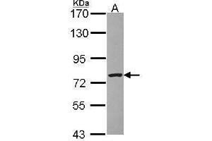 Western Blotting (WB) image for anti-Zinc Finger, BED-Type Containing 1 (ZBED1) (N-Term) antibody (ABIN2855173)