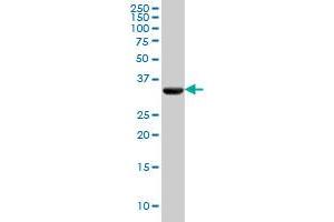 PDHB monoclonal antibody (M03), clone 2B2 Western Blot analysis of PDHB expression in HeLa . (PDHB 抗体  (AA 250-359))