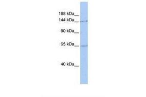 Image no. 1 for anti-Structural Maintenance of Chromosomes 1A (SMC1A) (C-Term) antibody (ABIN6737852) (SMC1A 抗体  (C-Term))