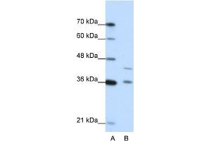 WB Suggested Anti-NKD2 Antibody Titration:  0. (NKD2 抗体  (N-Term))