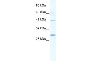 WB Suggested Anti-GJB4 Antibody Titration:  1. (GJB4 抗体  (Middle Region))