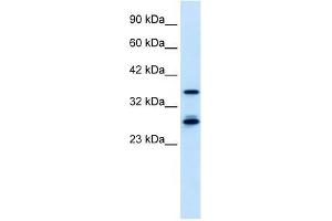 M96 antibody used at 0. (MTF2 抗体  (Middle Region))