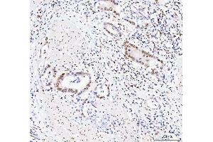 IHC analysis of DDX1 using anti-DDX1 antibody (ABIN7602052). (DDX1 抗体  (AA 562-740))
