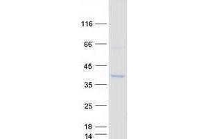 Western Blotting (WB) image for CDC42 Effector Protein (Rho GTPase Binding) 3 (CDC42EP3) protein (Myc-DYKDDDDK Tag) (ABIN2713841)