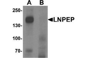 Western blot analysis of LNPEP in human lung tissue lysate with LNPEP Antibody  at 1 ug/mL in (A) the absence and (B) the presence of blocking peptide. (LNPEP 抗体  (C-Term))